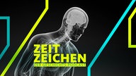 Die Parkinson-Krankheit: Veränderung im Nervensystem (Computergrafik)