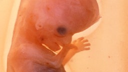 Embryo im Mutterleib