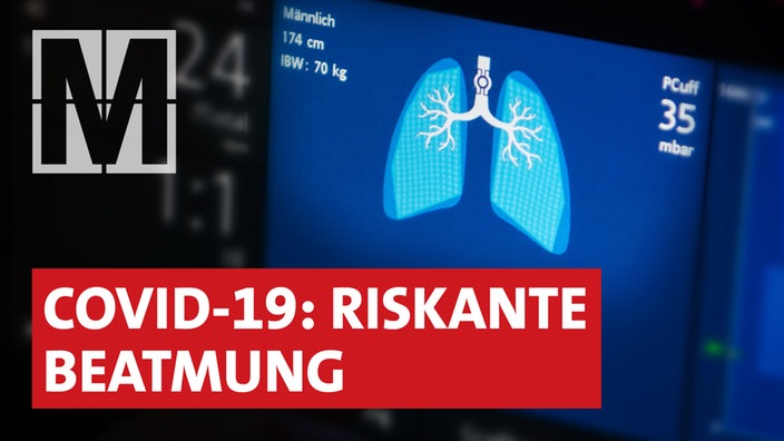 Überwachungsmonitor im Hintergrund. Covid-19: Riskante Beatmung