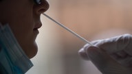 Antigentest