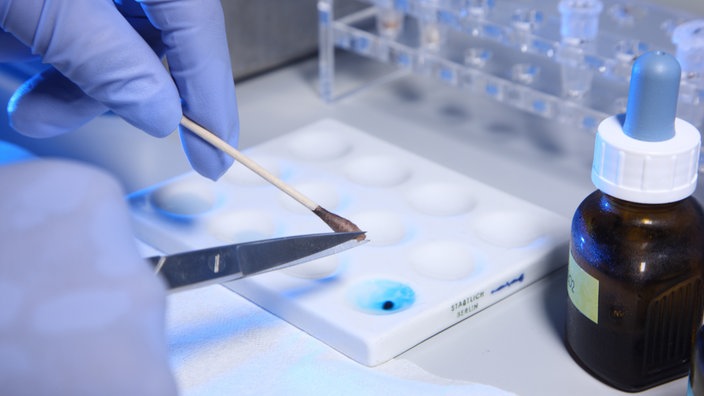 Spurenträger werden auf DNA-Spuren untersucht