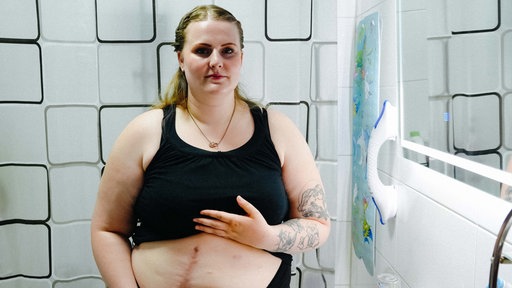 Eine Frau steht im Badezimmer neben einem Spiegel. Sie hat ihr schwarzes Top nach oben gezogen und zeigt ihre Narben am Bauch.