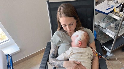 Julia Korbach hat ihre Tochter als Baby auf dem Arm, am Kopf des Kindes kleben viele Pflaster.