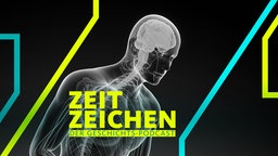 Die Parkinson-Krankheit: Veränderung im Nervensystem (Computergrafik)
