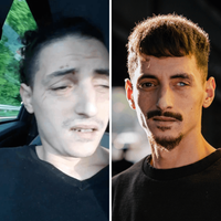 Auf der einen Seite ein gequälter, augenscheinlich kranker junger Mann mit Wunden im Gesicht, auf der anderen Seite der gleiche Mann gesund und gepflegt, nachdenklich in die Kamera blickend