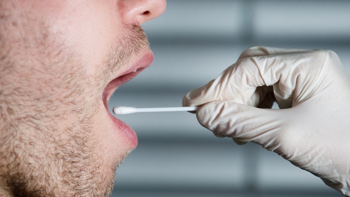 DNA-Analyse