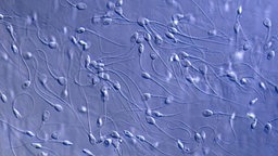 Spermium unter dem Microskop