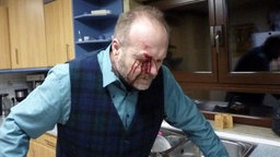 Ein Mann mit einer blutenden Wunde über dem Auge steht in einer Küche