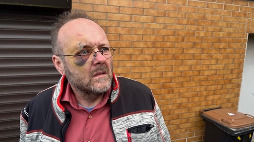 Ein Mann mit einem blauen Auge und einer Wunde über der Augenbraue blickt vor einer gelben Steinwand in die Kamera